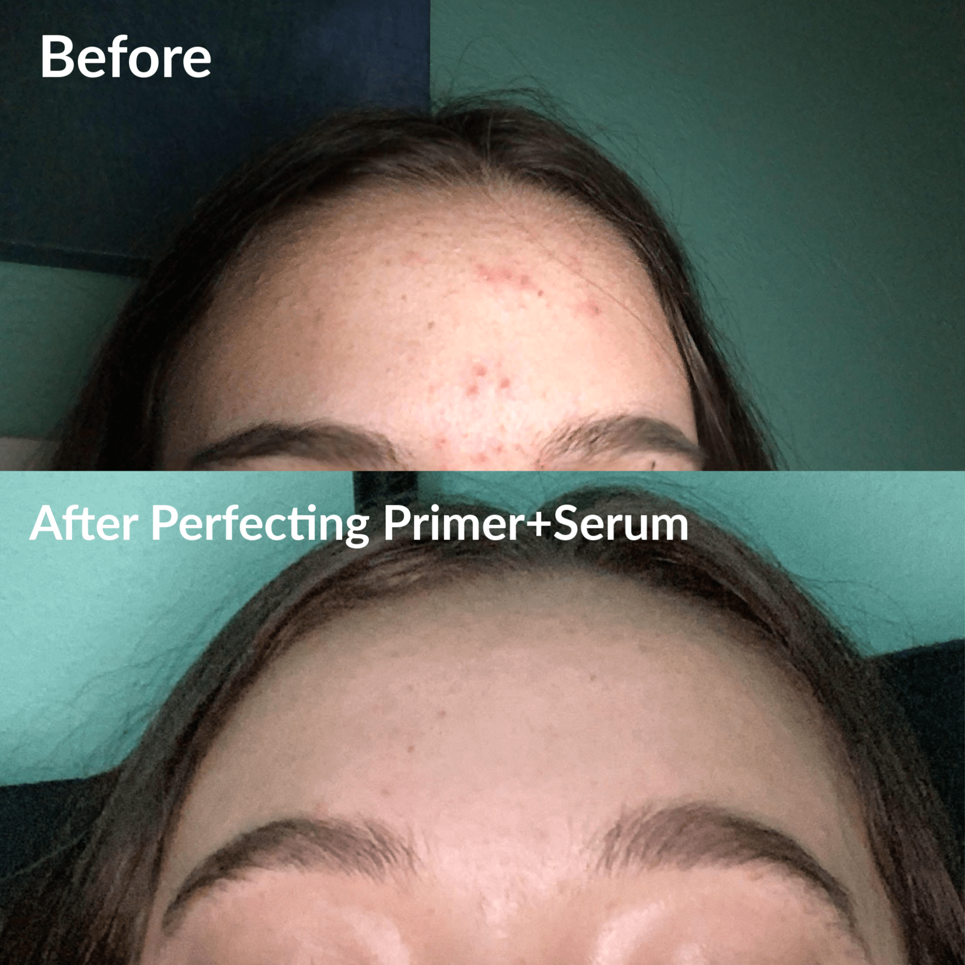 Perfecting Primer+Serum | Clear Skin Serum