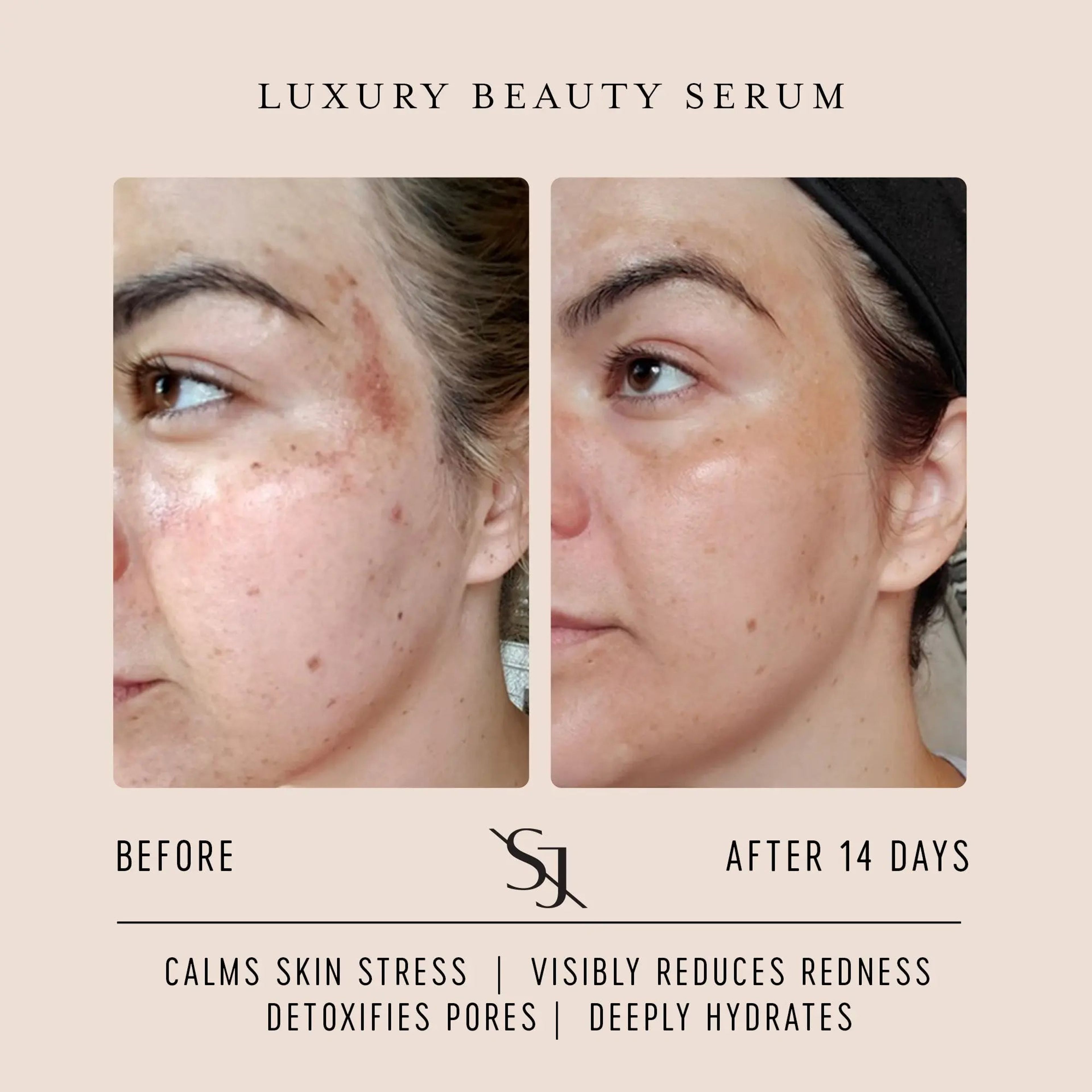 Luxury Beauty Serum - Powerful Calming Treatment