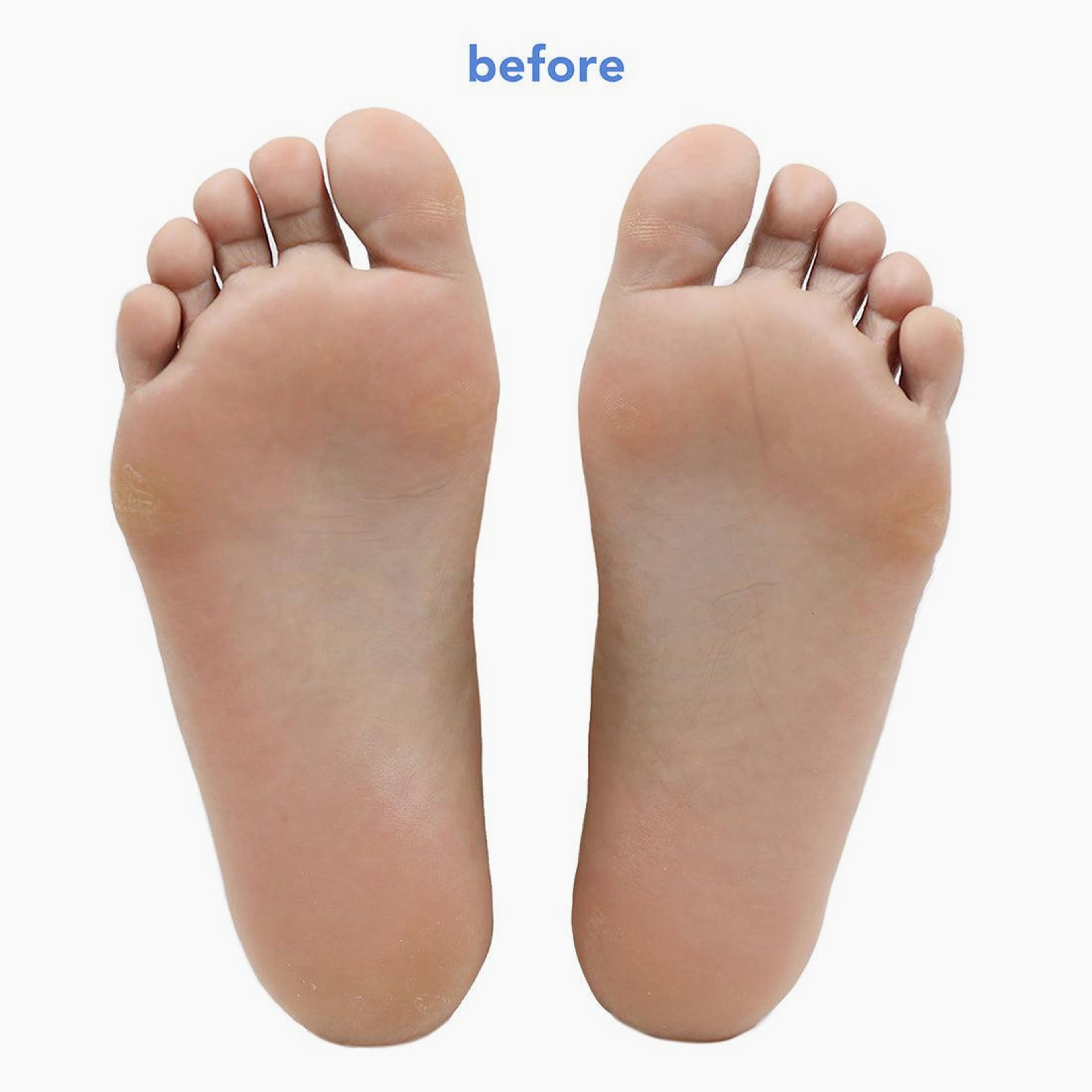 Fruit Acid Smoothing Foot Peel with plant-based alcohol