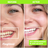 Laughland️ Teeth Whitening Kit  - Made By Dentists DRAFT
