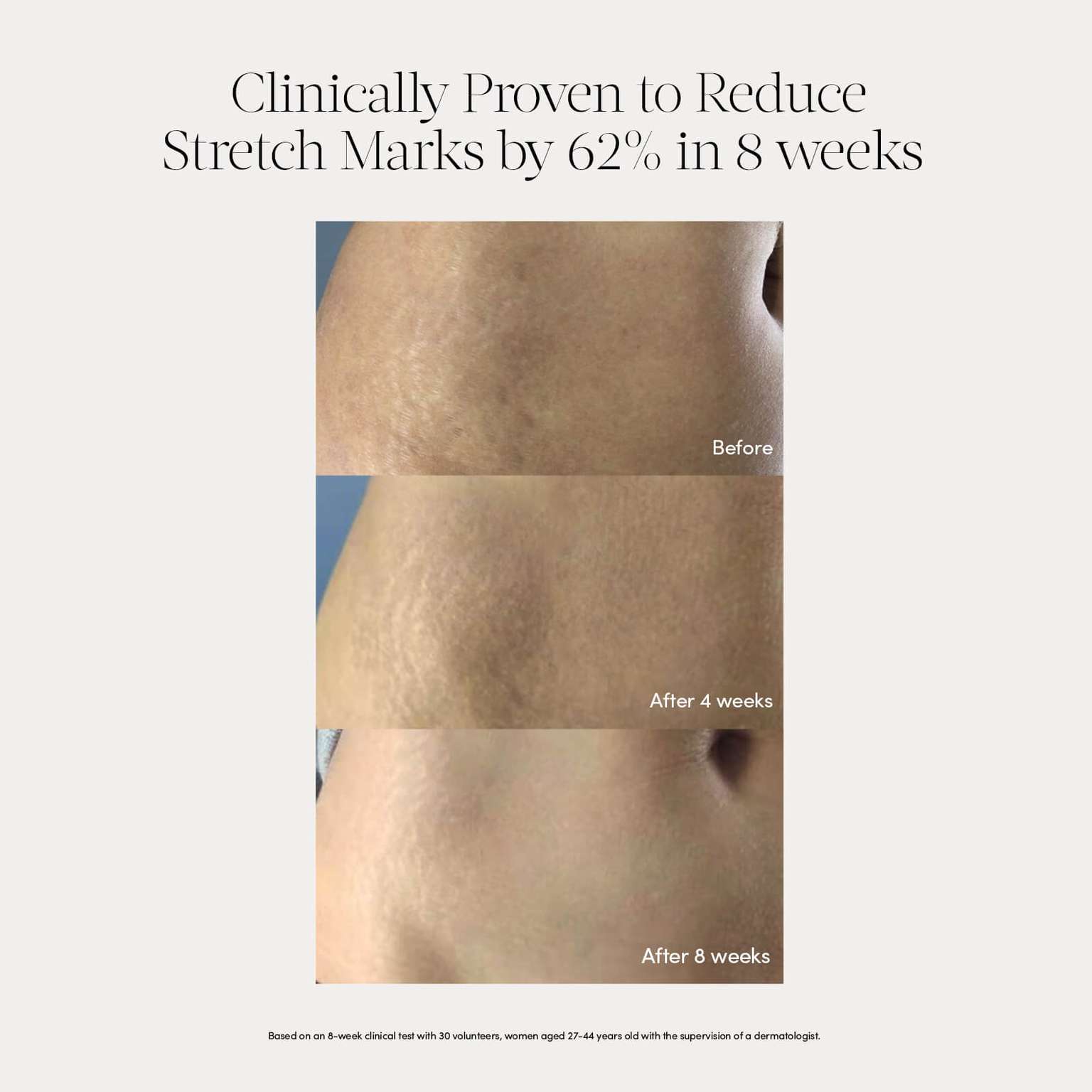 Golden Belly Serum